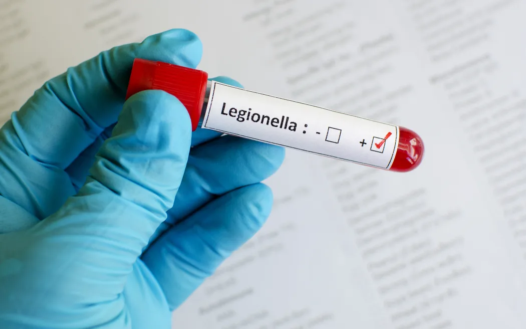 Deadly Legionnaires’ Disease Outbreak Hits Sydney